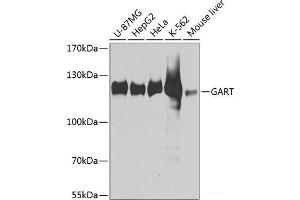 Western blot analysis of extracts of various cell lines using GART Polyclonal Antibody at dilution of 1:1000. (GART 抗体)