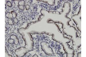 Immunoperoxidase of monoclonal antibody to API5 on formalin-fixed paraffin-embedded human small Intestine. (Apoptosis Inhibitor 5 抗体  (AA 400-504))
