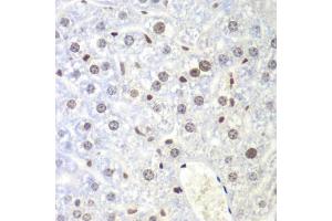 Immunohistochemistry of paraffin-embedded mouse liver using UHRF2 antibody (ABIN6133264, ABIN6149911, ABIN6149913 and ABIN6217665) at dilution of 1:200 (40x lens).