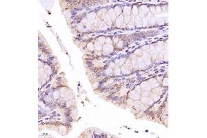 Immunohistochemistry of paraffin embedded rat rectum using SR140 (ABIN7076091) at dilution of 1:1000 (400x lens) (SR140 抗体)