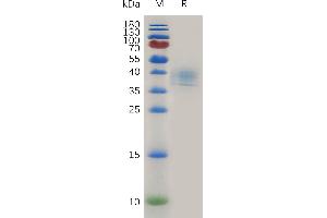 Human CD52 Protein, hFc Tag on SDS-PAGE under reducing condition.