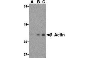 Western Blotting (WB) image for anti-Actin, beta (ACTB) (N-Term) antibody (ABIN1031270) (beta Actin 抗体  (N-Term))