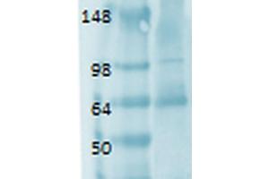 Western Blotting (WB) image for anti-Solute Carrier Family 5 (Sodium/iodide Cotransporter), Member 5 (SLC5A5) (AA 468-643) antibody (Biotin) (ABIN2484457)