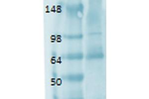 Western Blot analysis of Human thyroid lysate showing detection of Sodium Iodide Symporter protein using Mouse Anti-Sodium Iodide Symporter Monoclonal Antibody, Clone 14F . (SLC5A5 抗体  (AA 468-643) (Biotin))