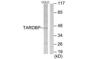 Western blot analysis of extracts from COLO205 cells, using TBX1 antibody. (T-Box 1 抗体  (C-Term))
