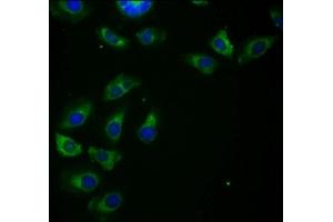 Immunofluorescence staining of A549 cells with ABIN7155085 at 1:266, counter-stained with DAPI. (HHLA2 抗体  (AA 172-258))