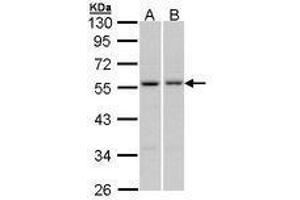 Image no. 1 for anti-Paired Box 6 (PAX6) (AA 1-221) antibody (ABIN467590) (PAX6 抗体  (AA 1-221))