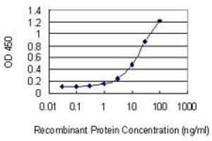 Detection limit for recombinant GST tagged CCNT2 is 0. (Cyclin T2 抗体  (AA 264-370))