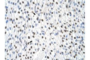 MSI2 antibody was used for immunohistochemistry at a concentration of 4-8 ug/ml to stain Myocardial cells (arrows) in Human Heart. (MSI2 抗体)