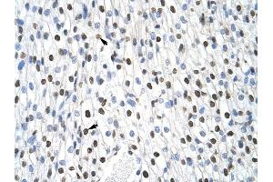 MSI2 antibody was used for immunohistochemistry at a concentration of 4-8 ug/ml to stain Myocardial cells (arrows) in Human Heart.