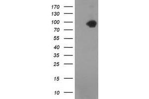 Western Blotting (WB) image for anti-Catenin (Cadherin-Associated Protein), beta 1, 88kDa (CTNNB1) antibody (ABIN1496888) (CTNNB1 抗体)