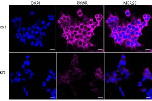 Immunocytochemical staining of HeLa cells using PAWR antibody (ABIN7799899), 1:1,000), Top panel: wild-type (WT), Bottom panal: PAWR shRNA knockdown (KD).