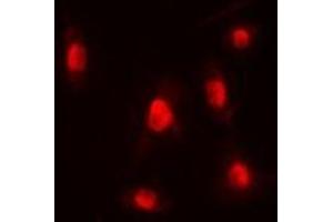 Immunofluorescent analysis of p300 staining in HEK293T cells. (p300 抗体  (N-Term))