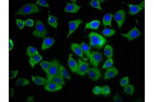 Immunofluorescence staining of A549 cells with ABIN7143338 at 1:233, counter-stained with DAPI. (ADCY8 抗体  (AA 534-670))