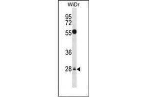 Western blot analysis of MED6 Antibody (Center) in WiDr cell line lysates (35ug/lane).
