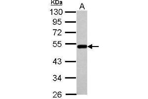 WB Image Sample (30 ug of whole cell lysate) A: A549 10% SDS PAGE antibody diluted at 1:1000 (BLMH 抗体)