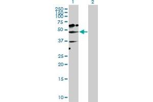 Western Blot analysis of NADK expression in transfected 293T cell line by NADK MaxPab polyclonal antibody.