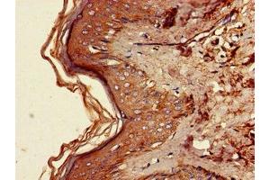 Immunohistochemistry of paraffin-embedded human skin tissue using ABIN7167757 at dilution of 1:100 (FAM134B 抗体  (AA 1-131))