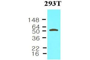 Western blot analysis: Cell lysates of 293T (30ug) were resolved by SDS-PAGE, transferred to NC membrane and probed with anti-human Visfatin (1:1000). (NAMPT 抗体)