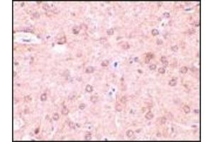 AP20054PU-N Beclin-1 antibody staining of Rat brain tissue by Immunohistochemistry at 2 μg/ml. (Beclin 1 抗体  (N-Term))