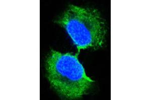 Immunocytochemistry (ICC) image for anti-Glutathione S-Transferase pi 1 (GSTP1) antibody (ABIN2983291) (GSTP1 抗体)