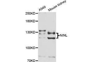Western blot analysis of extracts of various cell lines, using NINL antibody (ABIN5974637) at 1/1000 dilution. (NINL 抗体)