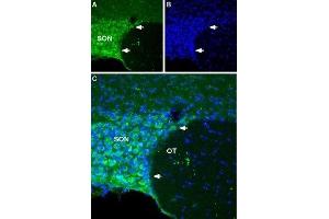 Expression of NALCN in rat hypothalamus - Immunohistochemical staining of rat hypothalamus using Anti-NALCN/VGCNL1 (extracellular) Antibody (ABIN7043658 and ABIN7045249). (NALCN 抗体  (Domain 3, Extracellular))