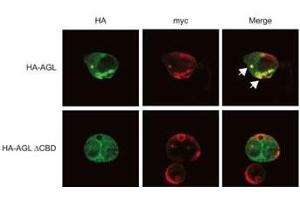 Expression of myc-GS causes wild type but not the ACBD mutant of AGL to aggregate around the S-stain-positive inclusions. (AGL 抗体  (C-Term))