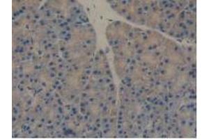 Figure. (REG3B 抗体  (AA 27-175))