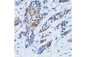 Immunohistochemistry (Paraffin-embedded Sections) (IHC (p)) image for anti-Inositol(myo)-1(or 4)-Monophosphatase 1 (IMPA1) (AA 1-277) antibody (ABIN6142429)