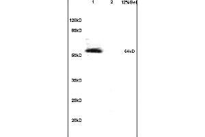Lane 1: mouse embryo lysates Lane 2: mouse brain lysates probed with Anti Phospho-IRF7 (Ser471/472) Polyclonal Antibody, Unconjugated (ABIN742703) at 1:200 in 4 °C. (IRF7 抗体  (pSer471, pSer472))