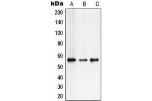 Western blot analysis of RUNX2 expression in Saos2 (A), HepG2 (B), Jurkat (C) whole cell lysates.