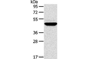 Western blot analysis of Human fetal brain tissue, using TM7SF2 Polyclonal Antibody at dilution of 1:500 (TM7SF2 抗体)