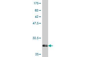 Western Blotting (WB) image for anti-Steroid-5-alpha-Reductase, alpha Polypeptide 2 (3-Oxo-5 alpha-Steroid delta 4-Dehydrogenase alpha 2) (SRD5A2) (AA 28-65) antibody (ABIN562991)