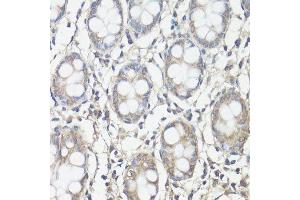 Immunohistochemistry of paraffin-embedded human colon using PTK2 antibody. (FAK 抗体  (AA 700-800))