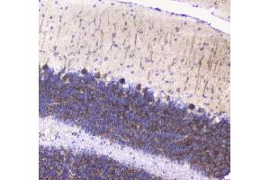 IHC analysis of Betacellulin using anti-Betacellulin antibody . (Betacellulin 抗体  (AA 32-177))