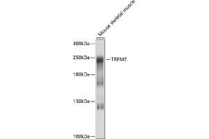 Western blot analysis of extracts of mouse skeletal muscle, using TRPM7 antibody (ABIN6127694, ABIN6149588, ABIN6149589 and ABIN6214200) at 1:1000 dilution. (TRPM7 抗体  (AA 756-855))