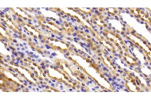 Immunohistochemistry (IHC) image for anti-Ferritin, Heavy Polypeptide 1 (FTH1) antibody (ABIN7437164)