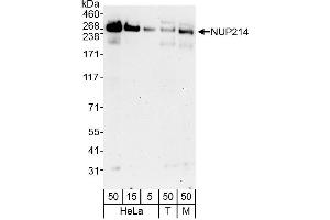 Western Blotting (WB) image for anti-Nucleoporin 214kDa (NUP214) (C-Term) antibody (ABIN7451908)