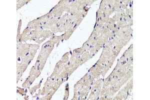 Immunohistochemistry of paraffin-embedded Mouse heart using ACSS2 Polyclonal Antibody at dilution of 1:100 (40x lens). (ACSS2 抗体)
