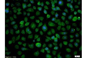 Immunofluorescence (IF) image for anti-Ras Association (RalGDS/AF-6) Domain Family Member 1 (RASSF1) (AA 145-260) antibody (ABIN673764)