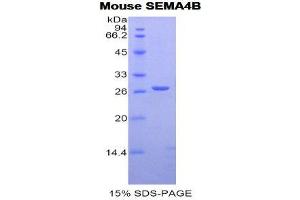 SDS-PAGE (SDS) image for Sema Domain, Immunoglobulin Domain (Ig), Transmembrane Domain (TM) and Short Cytoplasmic Domain, (Semaphorin) 4B (SEMA4B) (AA 31-240) protein (His tag) (ABIN1877926) (SEMA4B Protein (AA 31-240) (His tag))