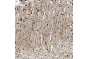Immunohistochemical staining (Formalin-fixed paraffin-embedded sections) of human heart muscle with TSPAN9 polyclonal antibody  shows moderate positivity in intercalated discs. (Tetraspanin 9 抗体  (AA 123-200))