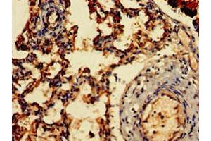 Immunohistochemistry of paraffin-embedded human lung tissue using ABIN7143442 at dilution of 1:100