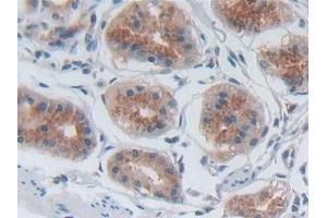 Detection of SELP in Human Stomach Tissue using Polyclonal Antibody to P-Selectin (SELP)