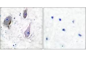 Immunohistochemistry analysis of paraffin-embedded human brain tissue, using PMP22 Antibody. (PMP22 抗体  (AA 111-160))