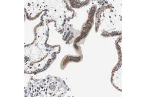 Immunohistochemical staining of human placenta with TMF1 polyclonal antibody  shows strong cytoplasmic positivity with granular pattern in trophoblastic cells at 1:200-1:500 dilution. (TMF1 抗体)