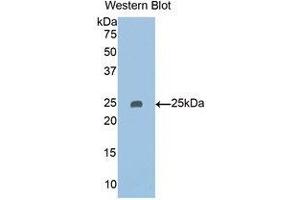 Western Blotting (WB) image for anti-Pappalysin 2 (PAPPA2) (AA 888-1093) antibody (ABIN1860128)