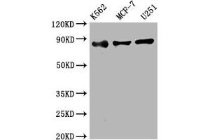 Western Blot Positive WB detected in: K562 whole cell lysate, MCF-7 whole cell lysate, U251 whole cell lysate All lanes: IKK beta antibody at 1:2000 Secondary Goat polyclonal to rabbit IgG at 1/50000 dilution Predicted band size: 87 kDa Observed band size: 87 kDa (Recombinant IKBKB 抗体)