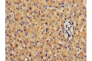 Immunohistochemistry of paraffin-embedded human liver tissue using ABIN7154093 at dilution of 1:100 (GSTA4 抗体  (AA 1-222))